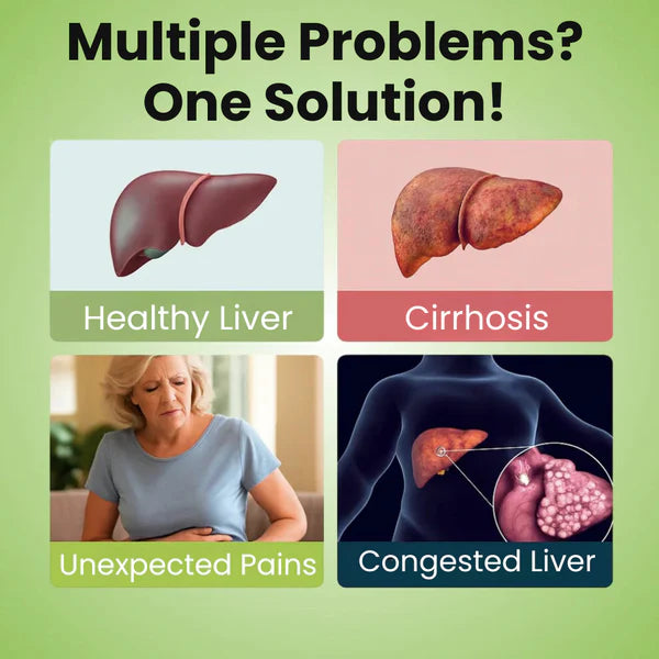 SerraNaturals Milk Thistle Liver Support